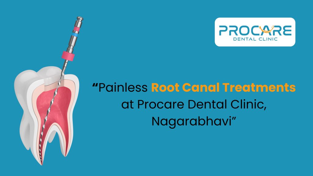 Painless Root Canal Treatments at Procare Dental Clinic, Banashankari