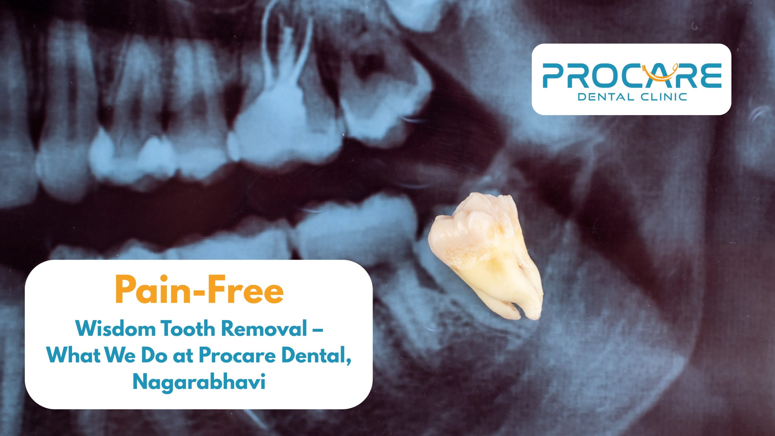 Pain-Free Wisdom Tooth Removal in Banashankari | Procare Dental Clinic