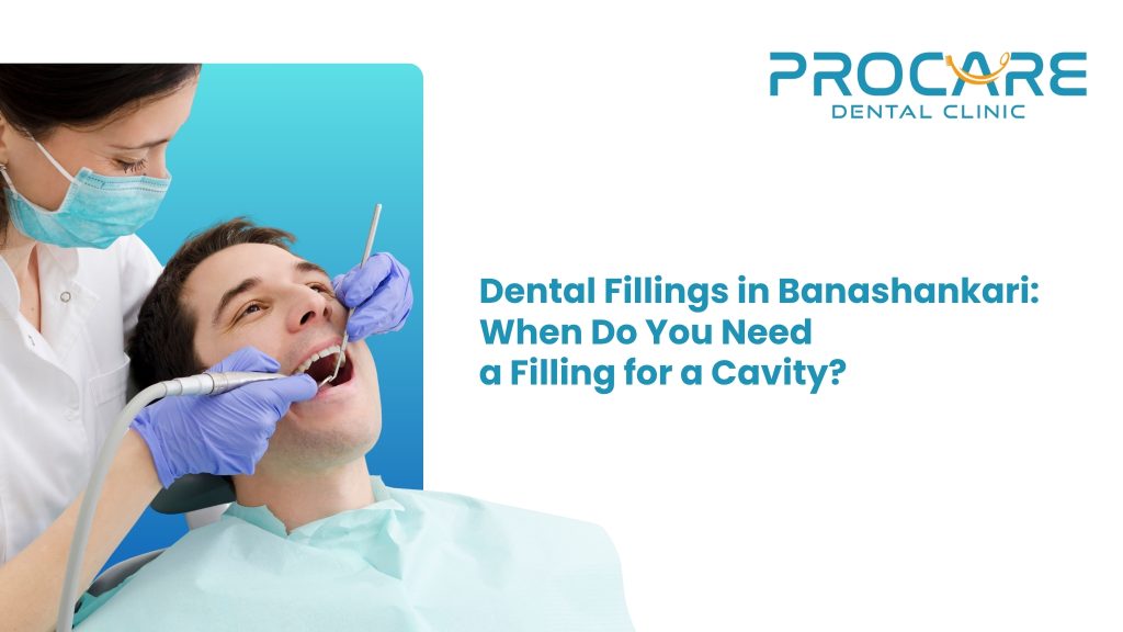 Dental Fillings in Banashankari: When Do You Need a Filling for a Cavity?